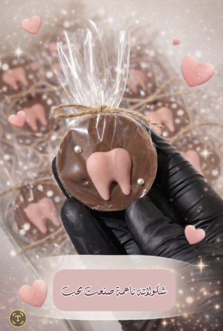 توزيعات سنونية